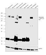 NMDAR2B Antibody in Western Blot (WB)