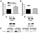 GluR2 Antibody in Western Blot, Immunoprecipitation (WB, IP)