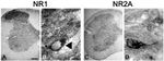 NMDAR1 Antibody in Immunohistochemistry (IHC)