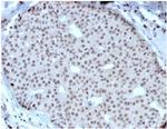 HOXB2 (Transcription Factor) Antibody in Immunohistochemistry (Paraffin) (IHC (P))