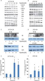 E2F1 Antibody in Western Blot, Immunoprecipitation (WB, IP)