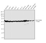 beta Tubulin Antibody in Western Blot (WB)