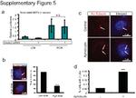 Acetyl-alpha Tubulin (Lys40) Antibody in Immunocytochemistry (ICC/IF)