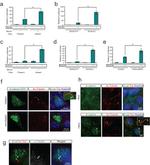 Acetyl-alpha Tubulin (Lys40) Antibody in Immunocytochemistry (ICC/IF)