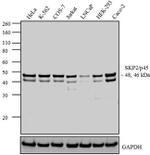 SKP2 Antibody in Western Blot (WB)