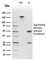 Haptoglobin (HP) Antibody in Immunoelectrophoresis (IE)