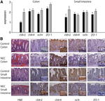 Occludin Antibody in Immunohistochemistry (IHC)