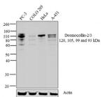 Desmocollin 2/3 Antibody