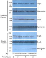 Desmoglein 3 Antibody in Western Blot (WB)