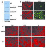 Desmoglein 3 Antibody in Immunocytochemistry (ICC/IF)