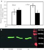 alpha Synuclein Antibody in Immunocytochemistry (ICC/IF)