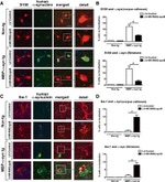 alpha Synuclein Antibody in Immunohistochemistry (IHC)