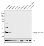 Synuclein alpha/beta Antibody in Western Blot (WB)