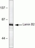 Lamin B2 Antibody in Western Blot (WB)