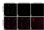 Ki-67 Antibody