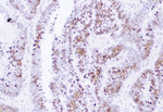 MSH2 Antibody in Immunohistochemistry (IHC)