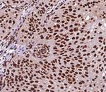 Heat shock 70 kDa protein 1B (HSPA1B) Antibody in Immunohistochemistry (Paraffin) (IHC (P))