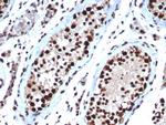 Heat shock 70 kDa protein 1B (HSPA1B) Antibody in Immunohistochemistry (Paraffin) (IHC (P))