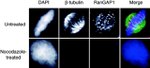 RANGAP1 Antibody in Immunocytochemistry (ICC/IF)