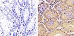 PLK1 Antibody in Immunohistochemistry (Paraffin) (IHC (P))