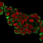 HSP60 (Heat Shock Protein 60) (Mitochondrial Marker) Antibody in Immunocytochemistry (ICC/IF)