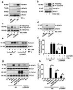 Phospho-STAT1 (Tyr701) Antibody in Western Blot (WB)