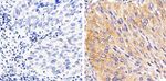 Phospho-STAT1 (Tyr701) Antibody in Immunohistochemistry (Paraffin) (IHC (P))