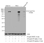 Phospho-STAT1 (Tyr701) Antibody