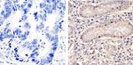 HSP70 Antibody in Immunohistochemistry (Paraffin) (IHC (P))