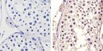 HSP70 Antibody in Immunohistochemistry (Paraffin) (IHC (P))