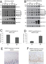 SRSF1 Antibody in Western Blot (WB)