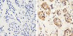 Bax Antibody in Immunohistochemistry (Paraffin) (IHC (P))