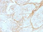 Tenascin C (Stromal Marker for Epithelial Malignancy) Antibody in Immunohistochemistry (Paraffin) (IHC (P))