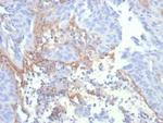 Tenascin C (Stromal Marker for Epithelial Malignancy) Antibody in Immunohistochemistry (Paraffin) (IHC (P))