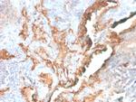 Tenascin C Antibody in Immunohistochemistry (Paraffin) (IHC (P))