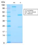 Tenascin C Antibody in SDS-PAGE (SDS-PAGE)