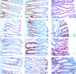 MSH2 Antibody in Immunohistochemistry (Paraffin) (IHC (P))