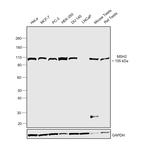 MSH2 Antibody in Western Blot (WB)