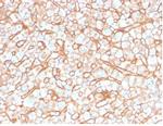 Apolipoprotein B/APOB Antibody in Immunohistochemistry (Paraffin) (IHC (P))