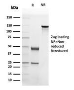 Apolipoprotein B/APOB Antibody in SDS-PAGE (SDS-PAGE)