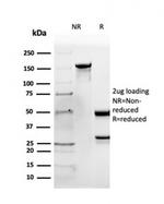 Apolipoprotein B /APOB Antibody in SDS-PAGE (SDS-PAGE)