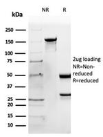 Apolipoprotein B/APOB Antibody in SDS-PAGE (SDS-PAGE)