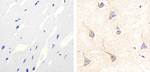 p38 MAPK beta Antibody in Immunohistochemistry (Paraffin) (IHC (P))