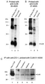 Connexin 36 Antibody in Immunoprecipitation (IP)