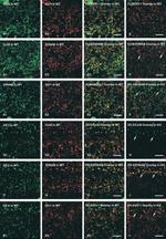 ZO-2 Antibody in Immunohistochemistry (IHC)