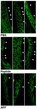 ZO-1 Antibody in Immunohistochemistry (Paraffin) (IHC (P))