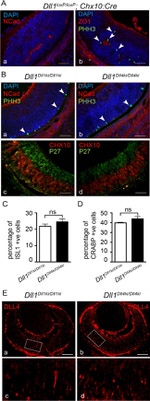 p27 Kip1 Antibody in Immunohistochemistry (IHC)