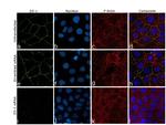 ZO-1 Antibody