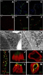 ZO-1 Antibody in Immunohistochemistry (IHC)