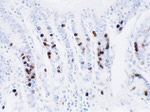 BrdU Antibody in Immunohistochemistry (IHC)